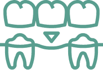 Crowns and Bridgework