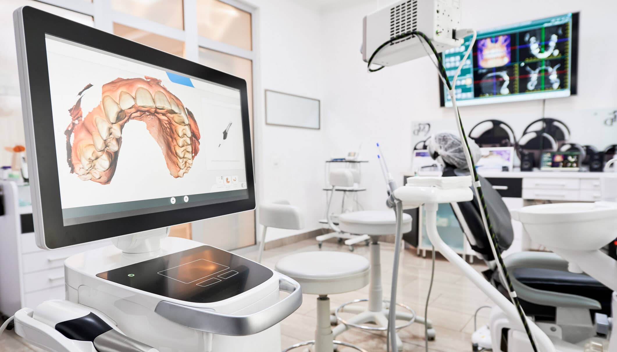 Interior of dental office with modern equipment and dental intraoral scanner with teeth on display, medical system for intraoral scanning. Concept of digital dentistry and dental scanning technology.