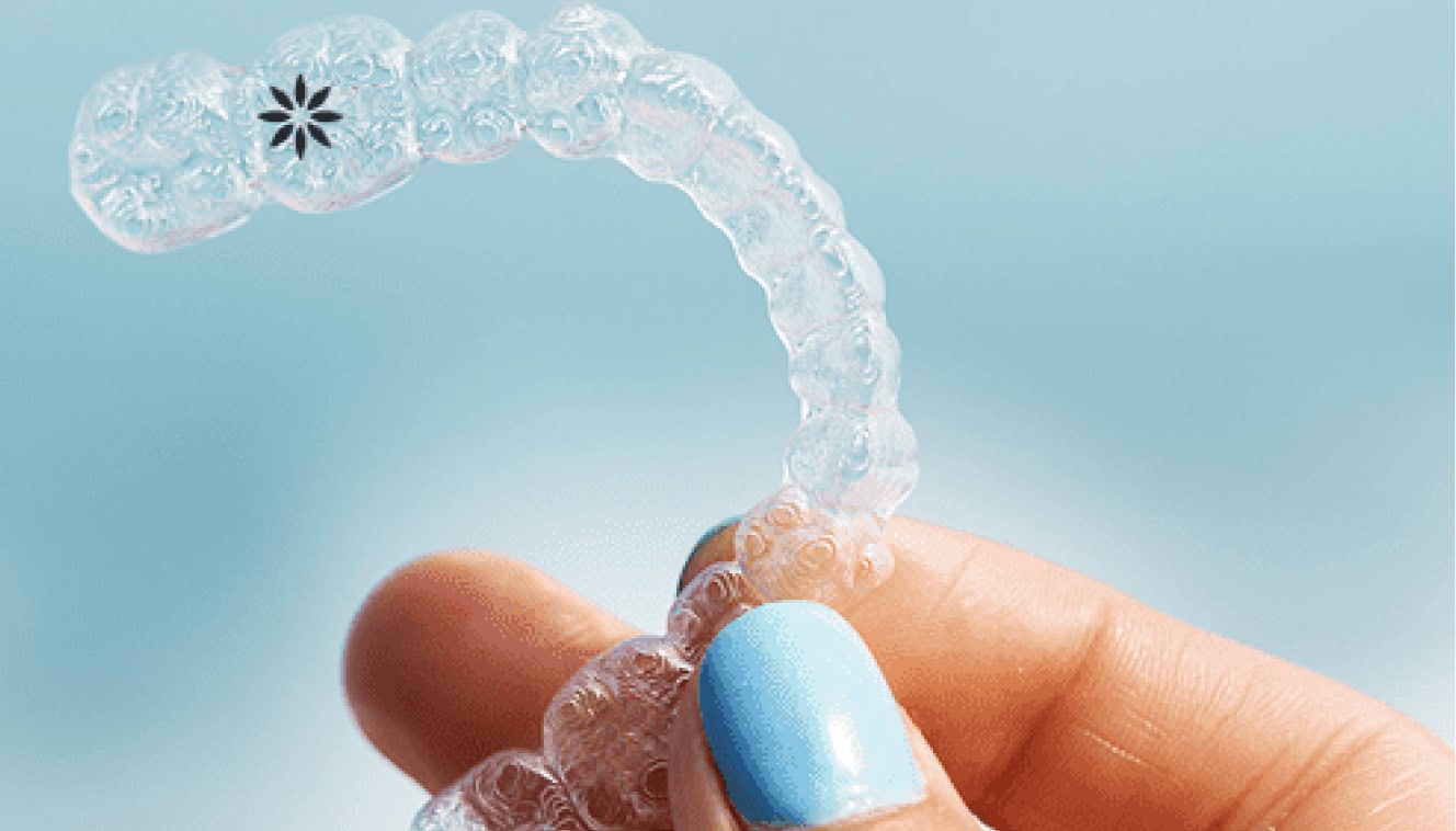 invisalign modern procedure
